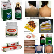 OQ DOGLARni YOQOTISH PIGMENTO VITILIGO DAVOSI